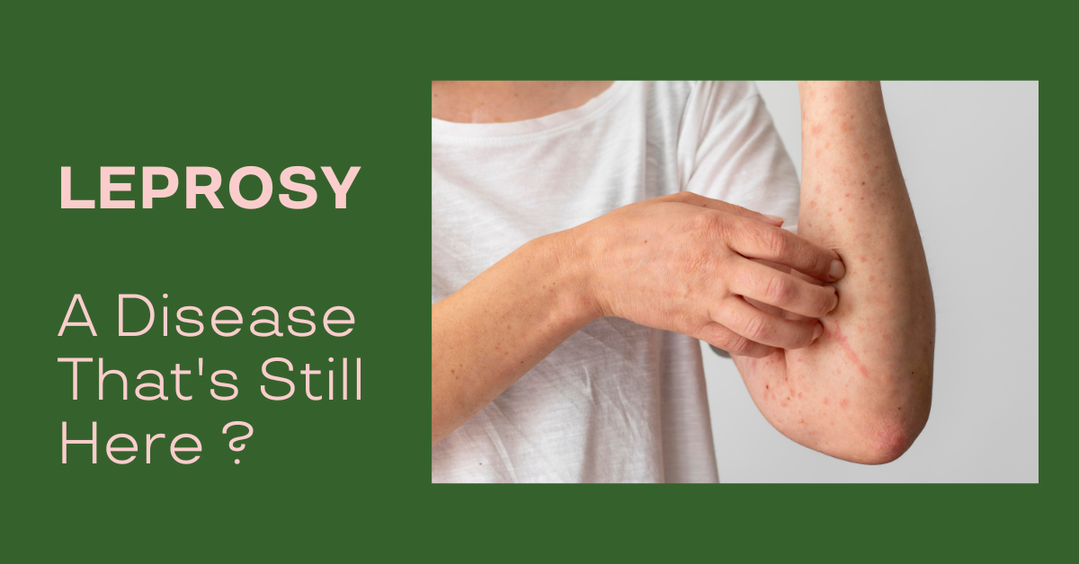 Leprosy in Florida